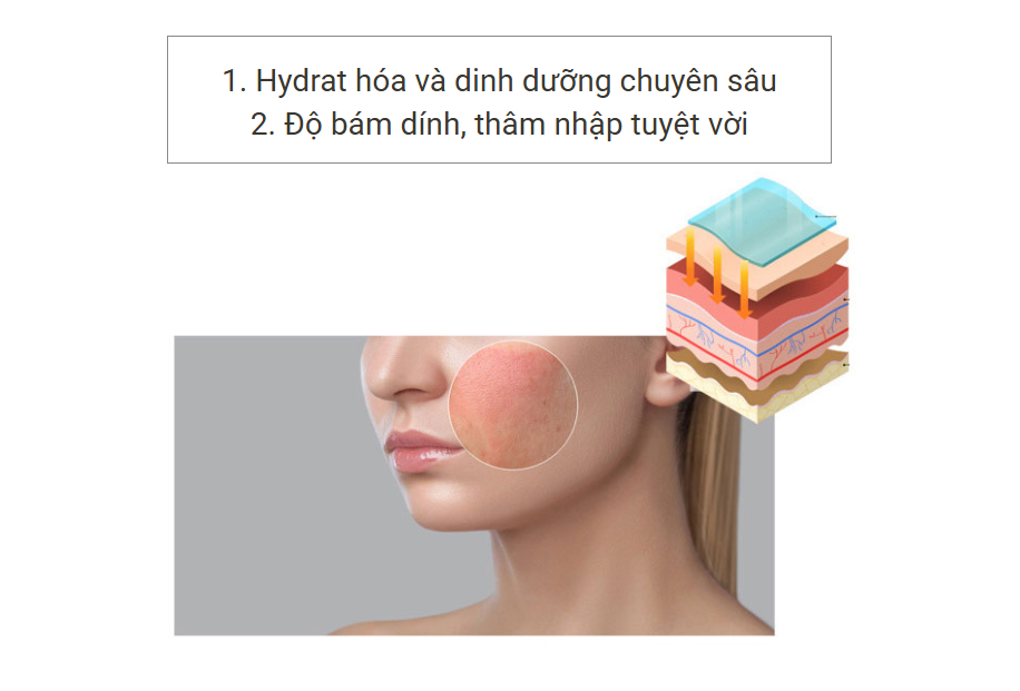 hygro 5.png